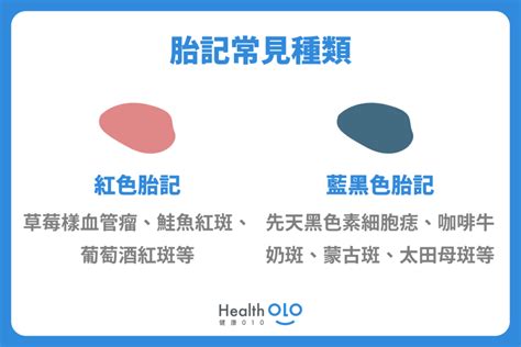 手上有胎記|胎記怎麼產生、何時消除？醫師剖析胎記種類、胎記寓意